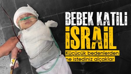 İsrail ataklarında kolu kopan Gazzeli minik bebek